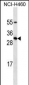 PRL Antibody (Ascites)